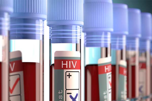 Portadores de HIV têm expectativa de vida reduzida?